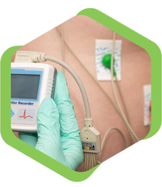 Holter Monitor Test in Kolkata Holter Monitor Test in Kolkata