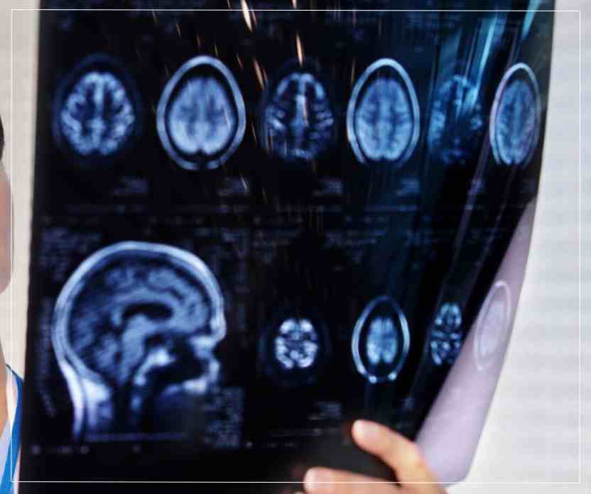 Diseases Treated by a Neurology Doctor in Naktala Diseases Treated by a Neurology Doctor in Naktala