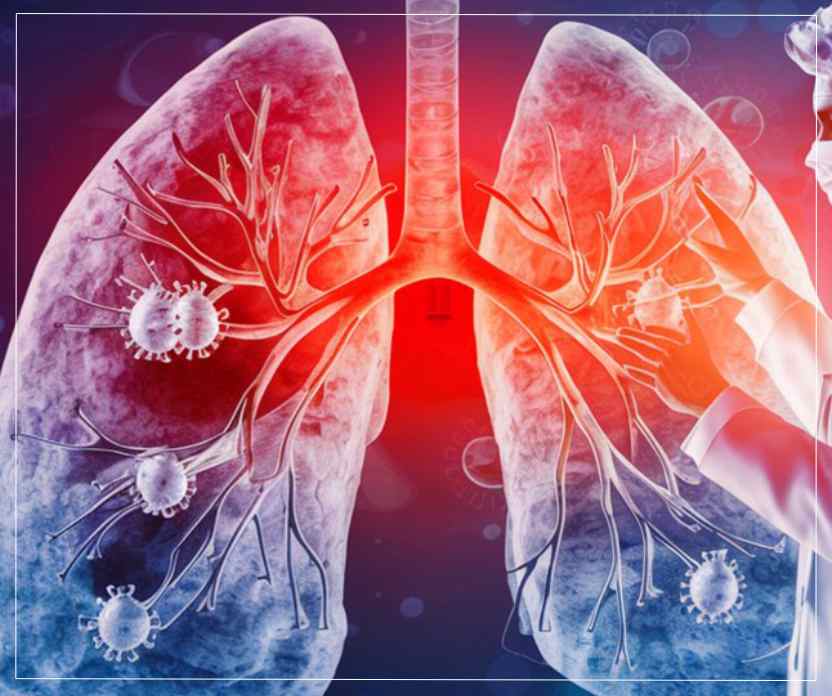 Diseases Treated by a Lung Specialist in Kolkata Diseases Treated by a Lung Specialist in Kolkata