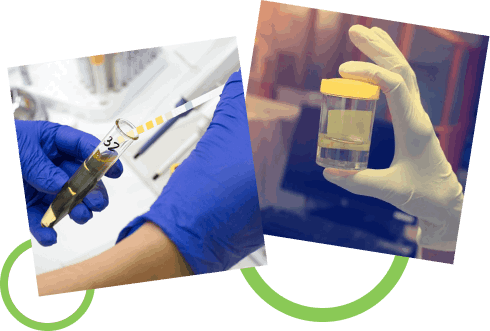 How Does the Uroflowmetry Test in Naktala Work? How Does the Uroflowmetry Test in Naktala Work?