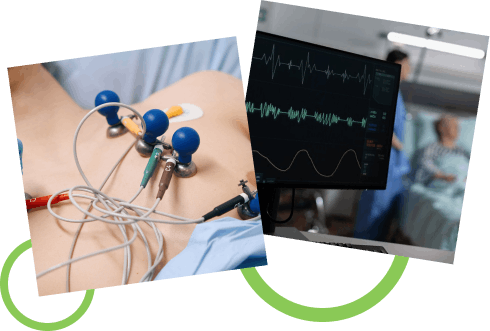 How the ECG Test Works How the ECG Test Works