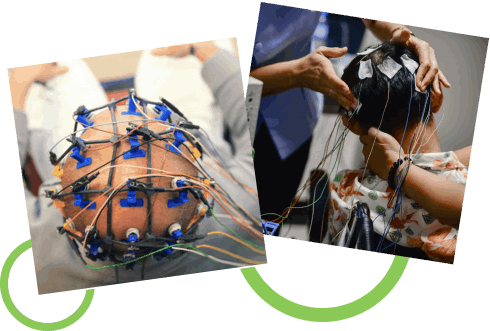 How the EEG Test Works How the EEG Test Works