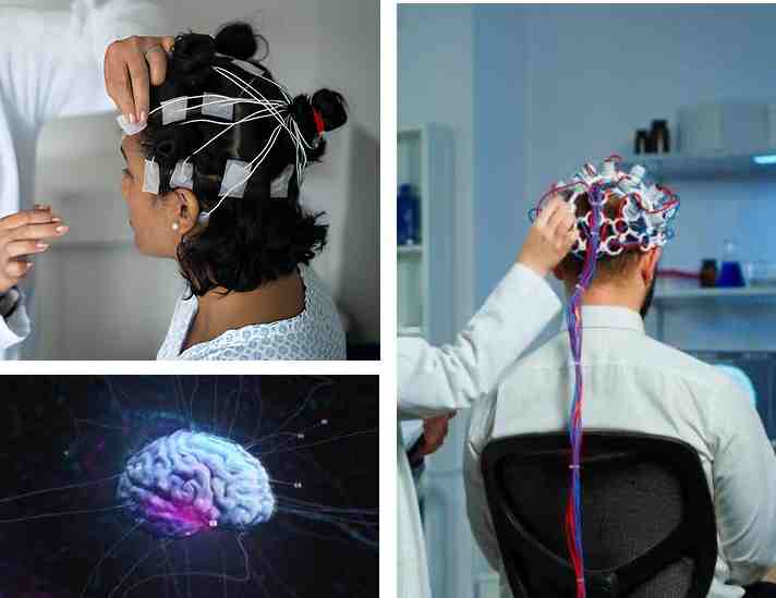 Why Choose Sugarline Health Care for Your EEG? Why Choose Sugarline Health Care for Your EEG?