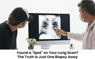 Found a “Spot” on Your Lung Scan? The Truth Is Just One Biopsy Away