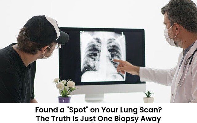Found a “Spot” on Your Lung Scan? The Truth Is Just One Biopsy Away